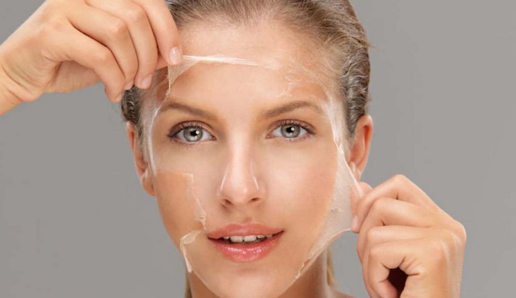 Chemical Skin Peels – Make You Look Younger and Healthier Skin