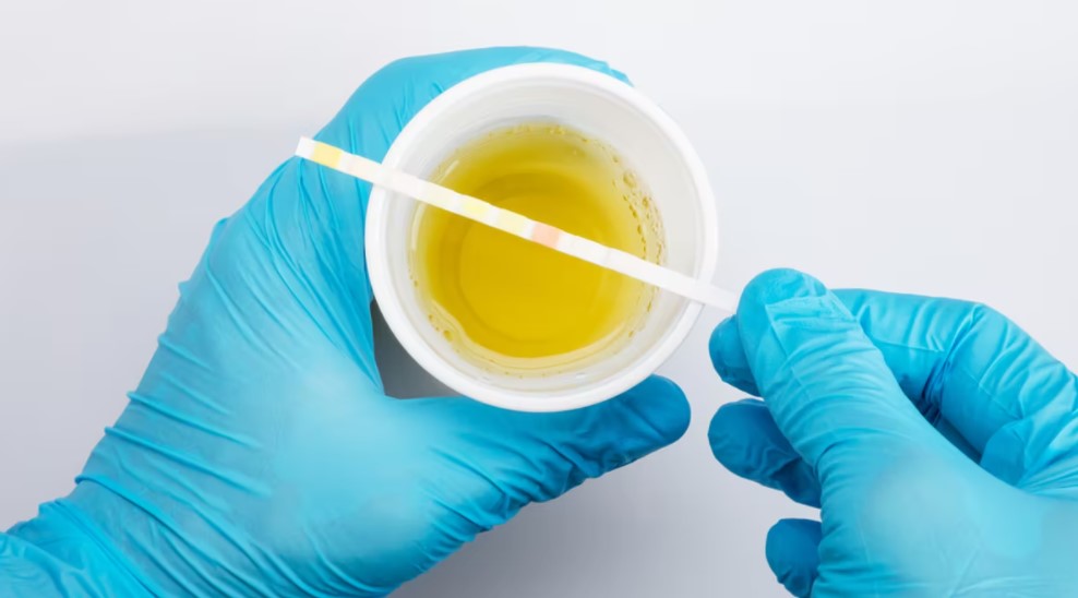 Urine Drug Testing Procedures: What You Should Know