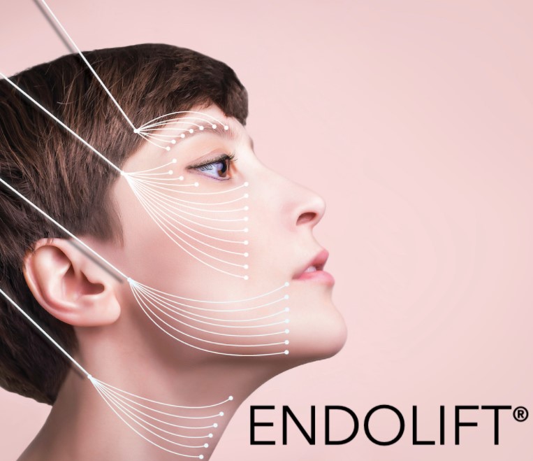 What Exactly Is The Endolift Laser Network, And What Does It Accomplish?