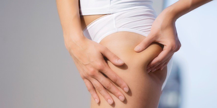 How Can I Lose Both My Cellulite And My Extra Fat?